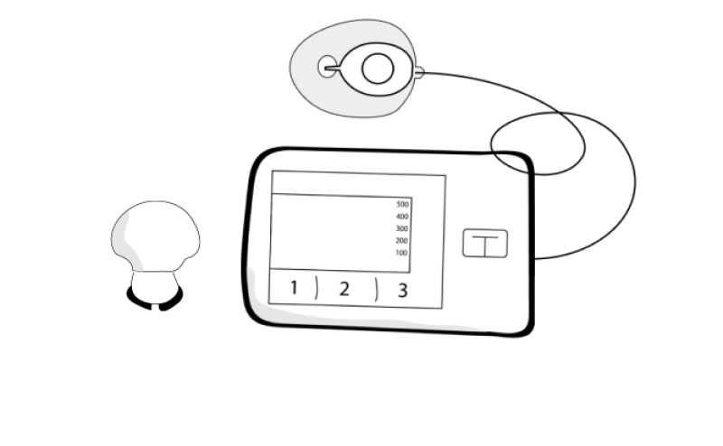 MedtronicTandem